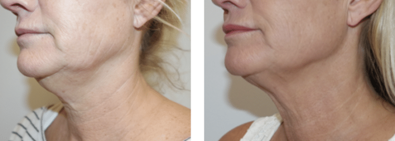 TotalSkin Solution