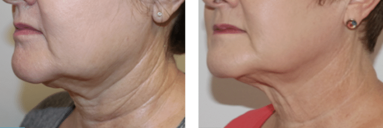 TotalSkin Solution