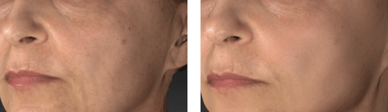 TotalSkin Solution